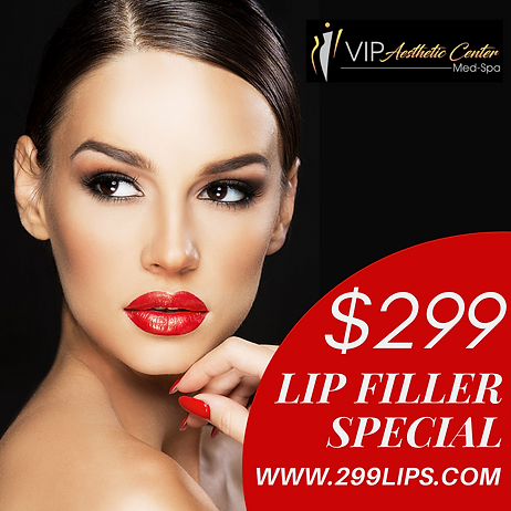 Revanesse Versa Lip Fillers | VIP Aesthetic Center | Miami